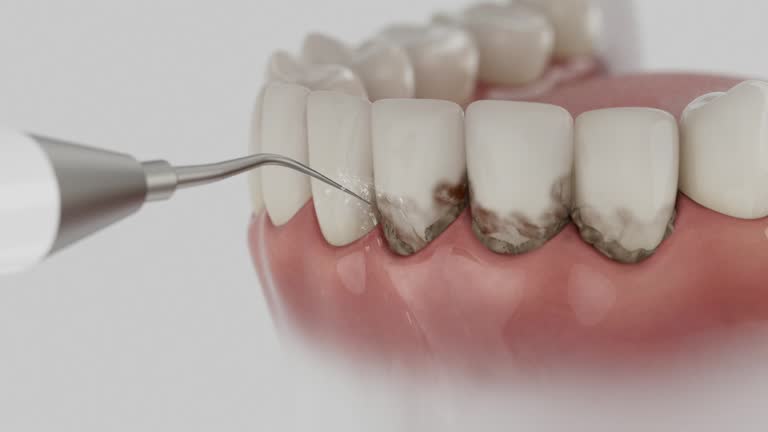 Trusted Root Canal Treatment service in Oxford, MS - Dentist Open Now